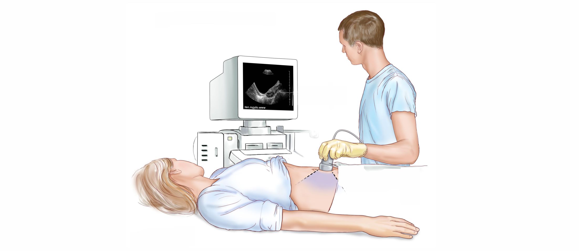 Ultrazvučni pregled abdomena ultarzvuk stomaka i male karlice